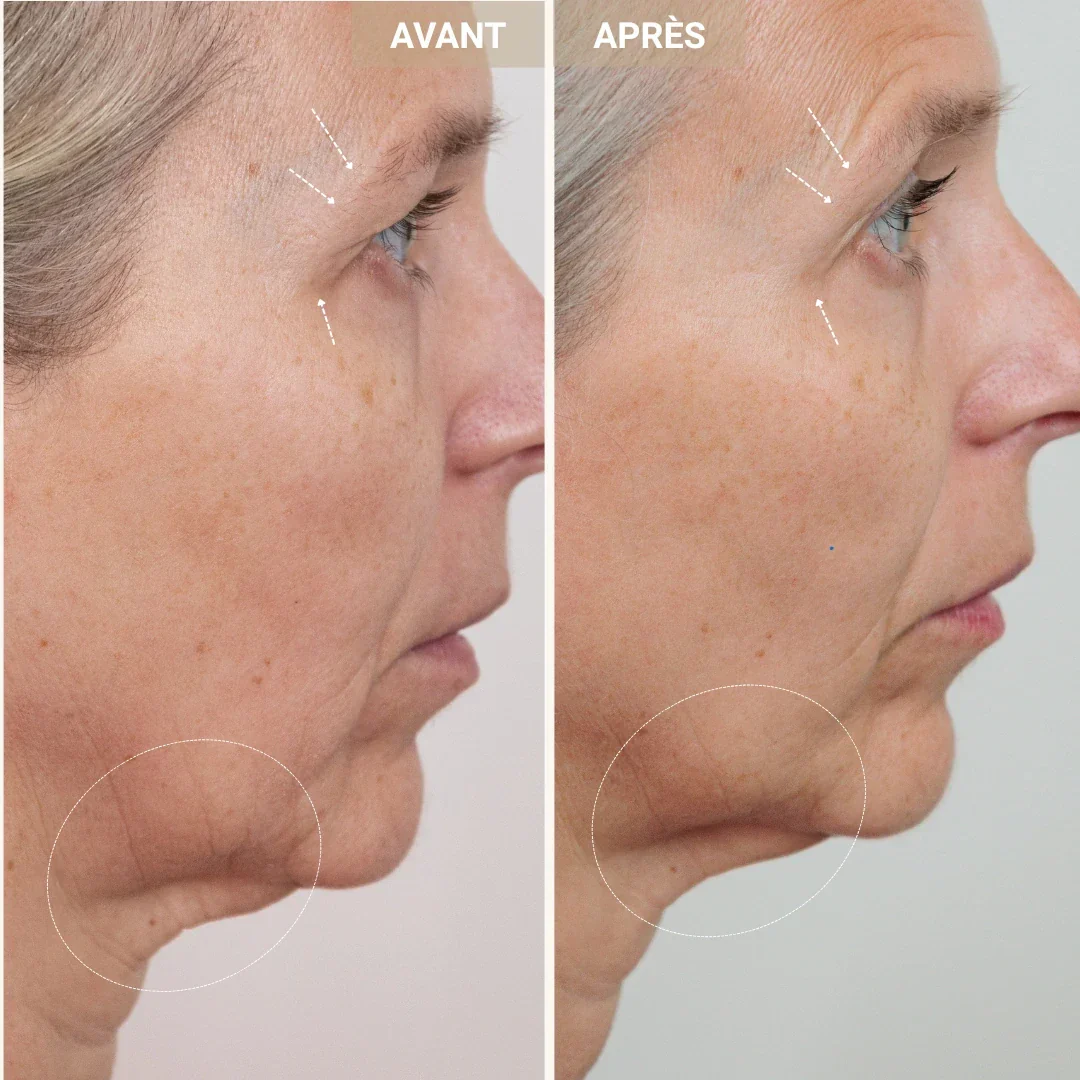 Sérum jeunesse 2% peptides de cuivre - Image 6