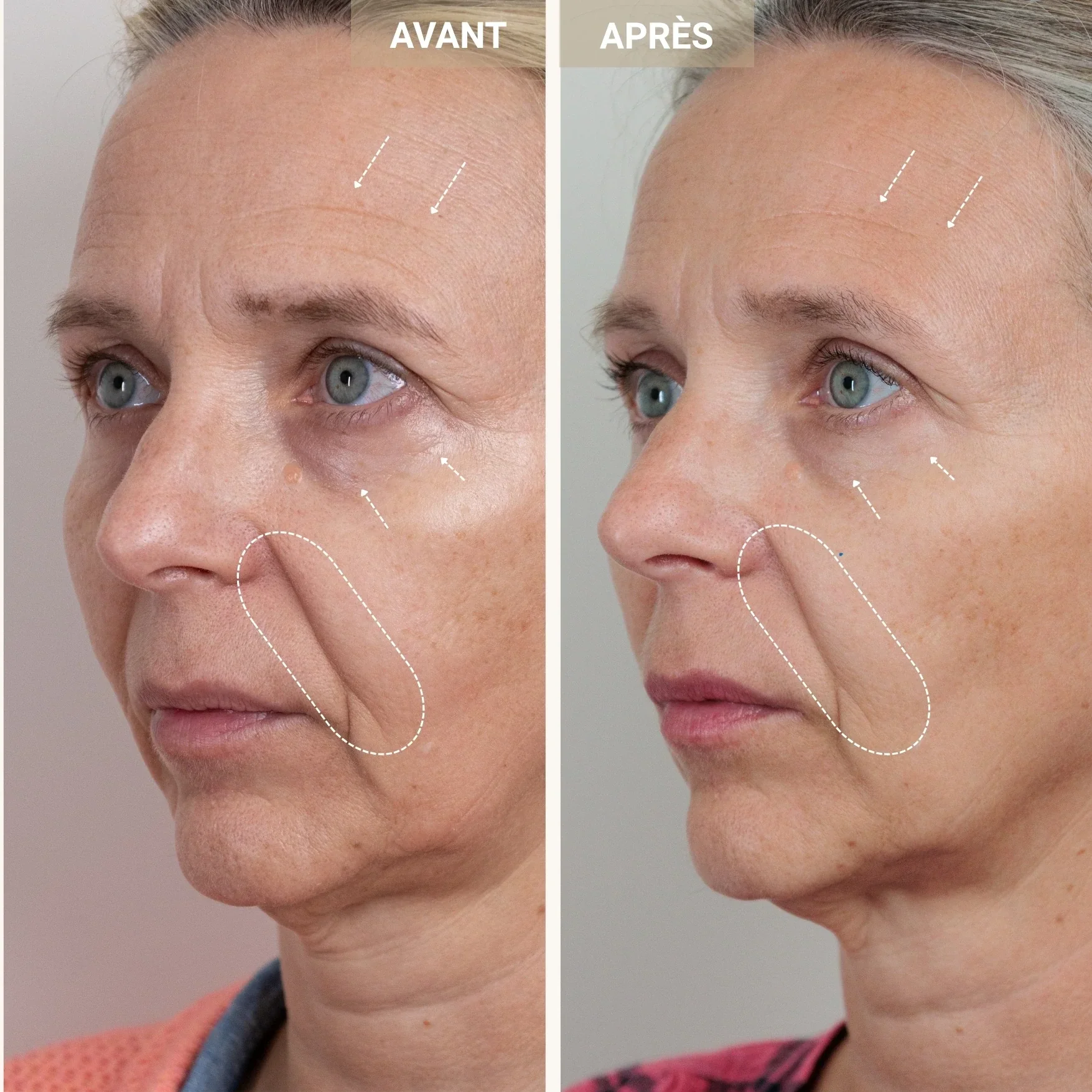 Sérum jeunesse 2% peptides de cuivre - Image 9